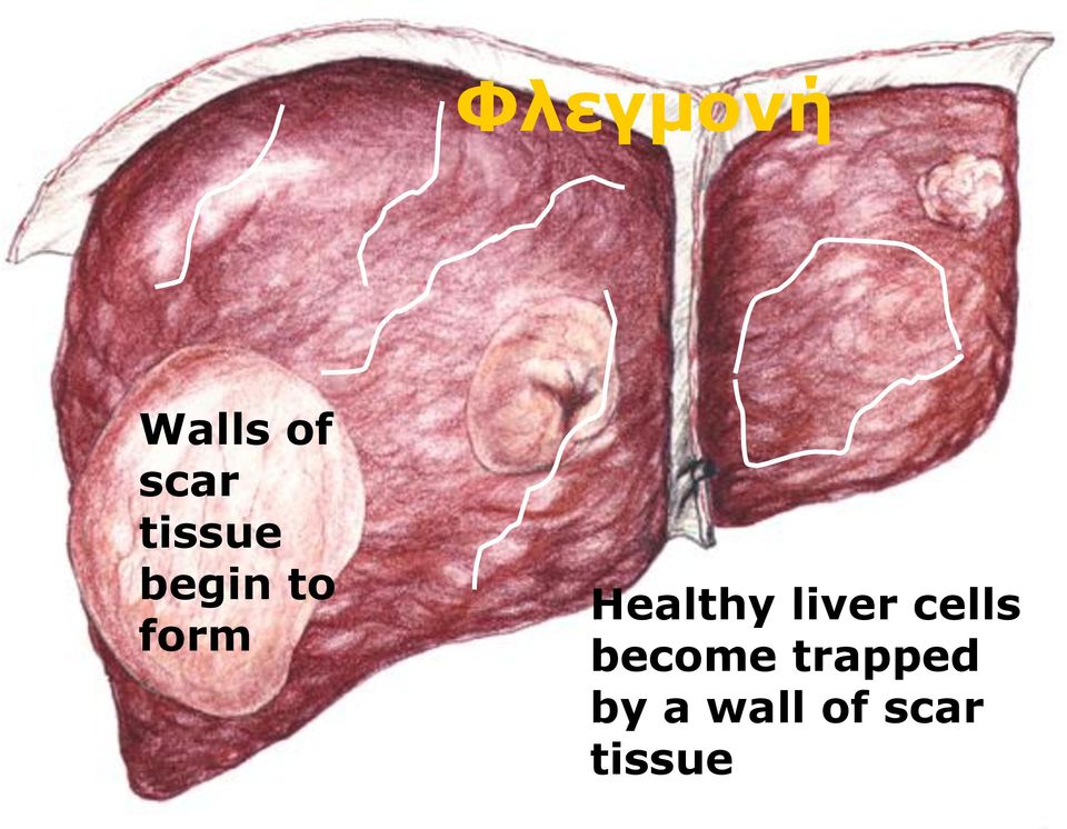 Healthy liver cells