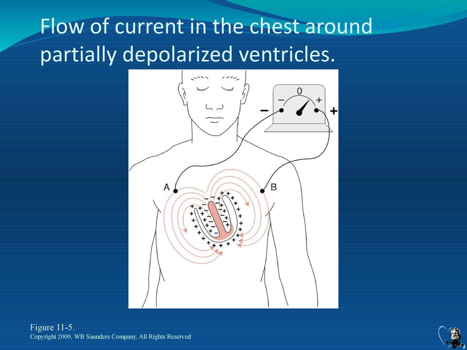 ventricles. Figure 11-5.