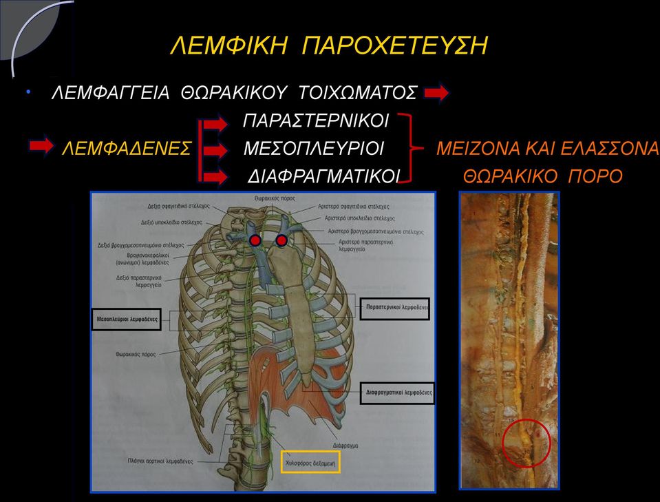 ΛΕΜΦΑΔΕΝΕΣ ΜΕΣΟΠΛΕΥΡΙΟΙ