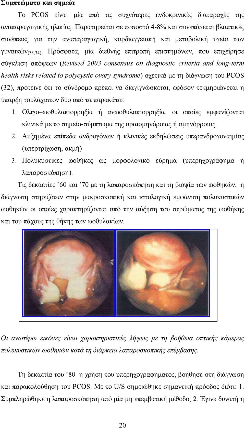 Πρόσφατα, µία διεθνής επιτροπή επιστηµόνων, που επιχείρησε σύγκλιση απόψεων (Revised 2003 consensus on diagnostic criteria and long-term health risks related to polycystic ovary syndrome) σχετικά µε