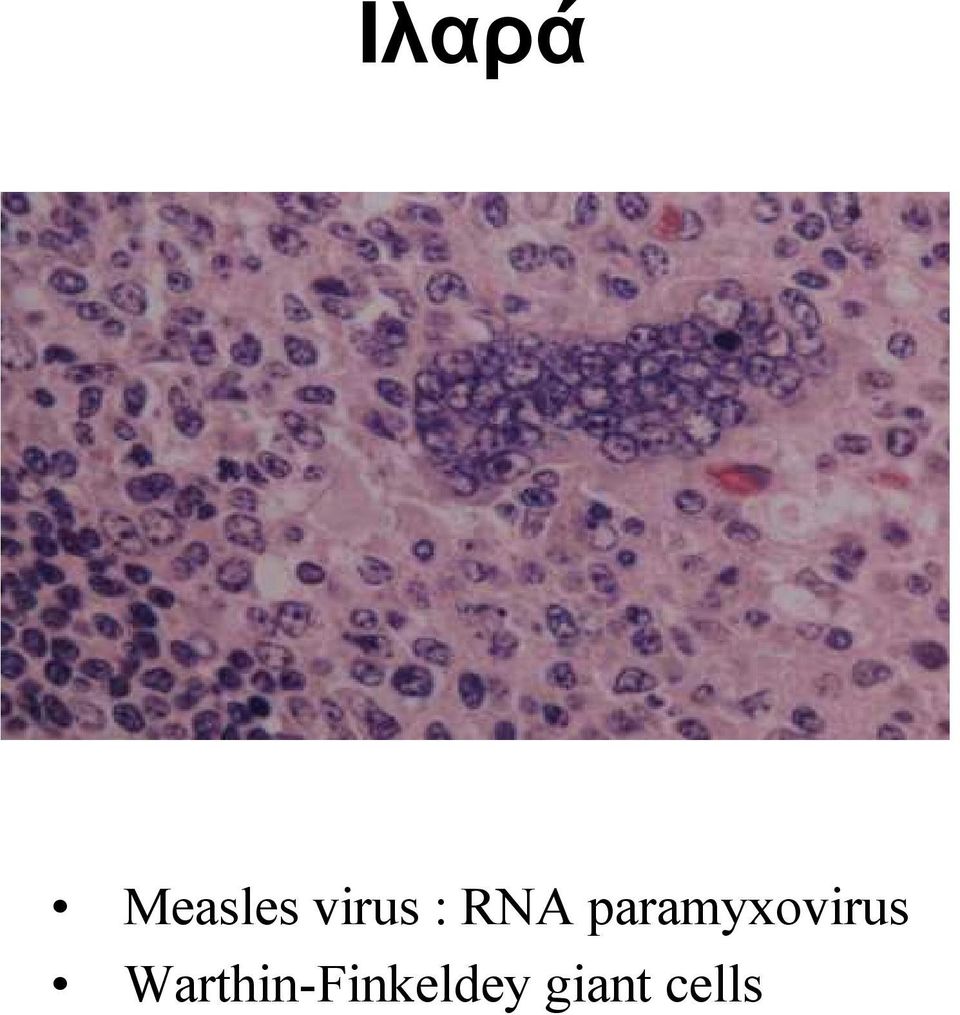 paramyxovirus