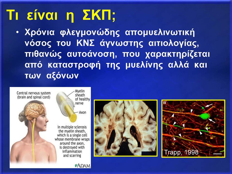 αιτιολογίας, πιθανώς αυτοάνοση, που