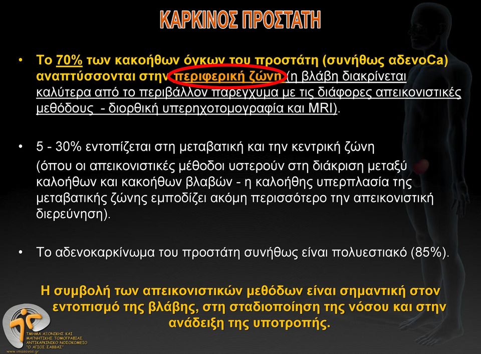 5-30% εντοπίζεται στη μεταβατική και την κεντρική ζώνη (όπου οι απεικονιστικές μέθοδοι υστερούν στη διάκριση μεταξύ καλοήθων και κακοήθων βλαβών - η καλοήθης υπερπλασία της