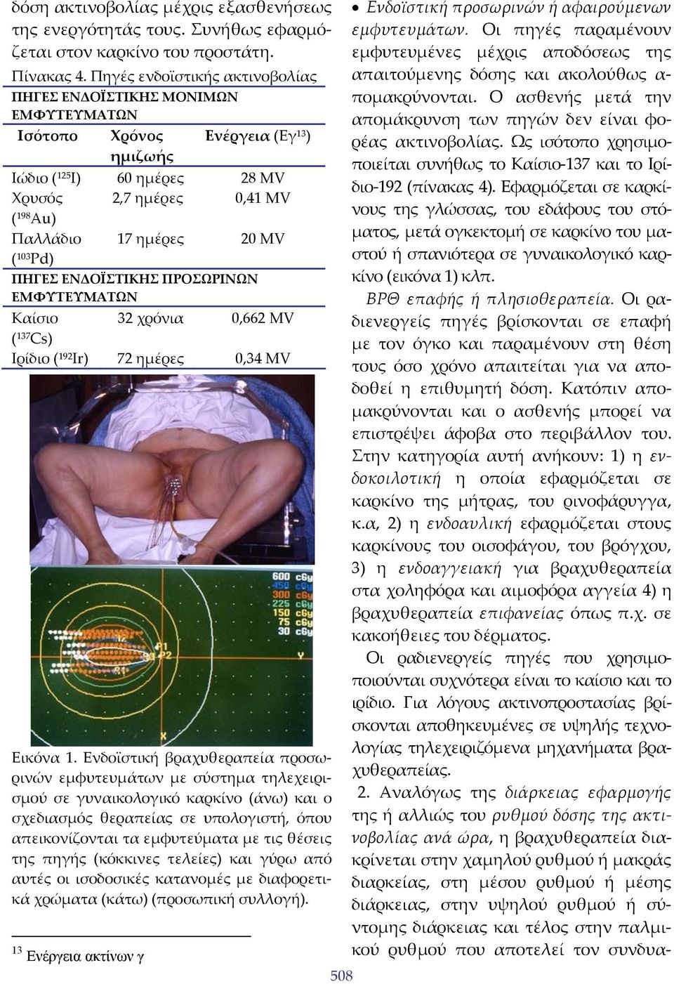 ημέρες 20 ΜV ΠΗΓΕΣ ΕΝΔΟΪΣΤΙΚΗΣ ΠΡΟΣΩΡΙΝΩΝ ΕΜΦΥΤΕΥΜΑΤΩΝ Καίσιο 32 χρόνια 0,662 ΜV ( 137 Cs) Ιρίδιο ( 192 Ιr) 72 ημέρες 0,34 ΜV Εικόνα 1.