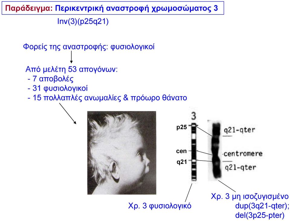 αποβολές - 31 φυσιολογικοί - 15 πολλαπλές ανωμαλίες & πρόωρο θάνατο