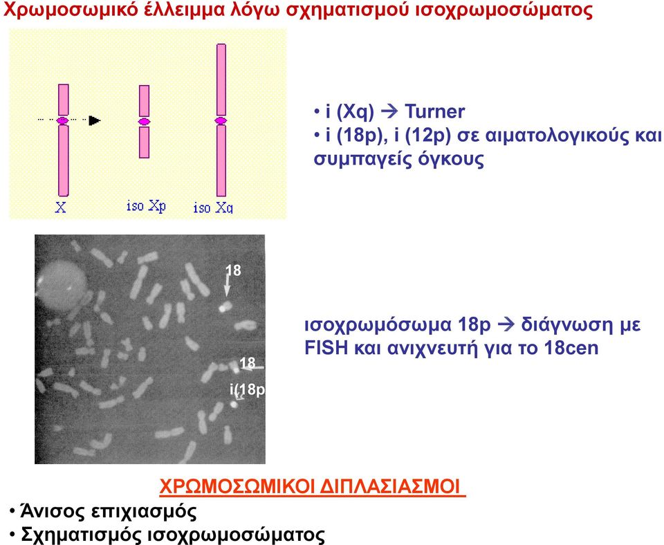 i(18p) ισοχρωμόσωμα 18p διάγνωση με FISH και ανιχνευτή για το 18cen