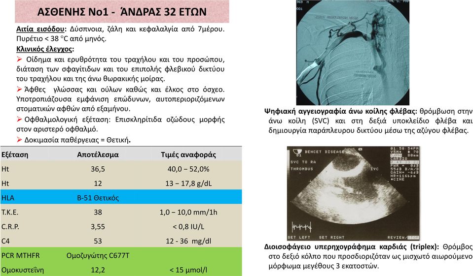 Άφθες γλώσσας και ούλων καθώς και έλκος στο όσχεο. Υποτροπιάζουσα εμφάνιση επώδυνων, αυτοπεριοριζόμενων στοματικών αφθών από εξαμήνου.