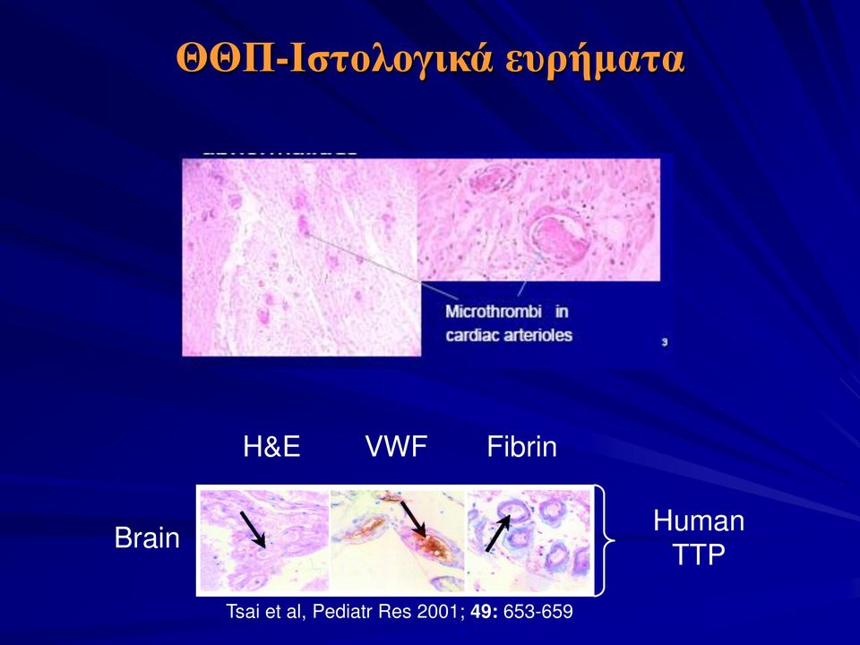 Human TTP Tsai et al,