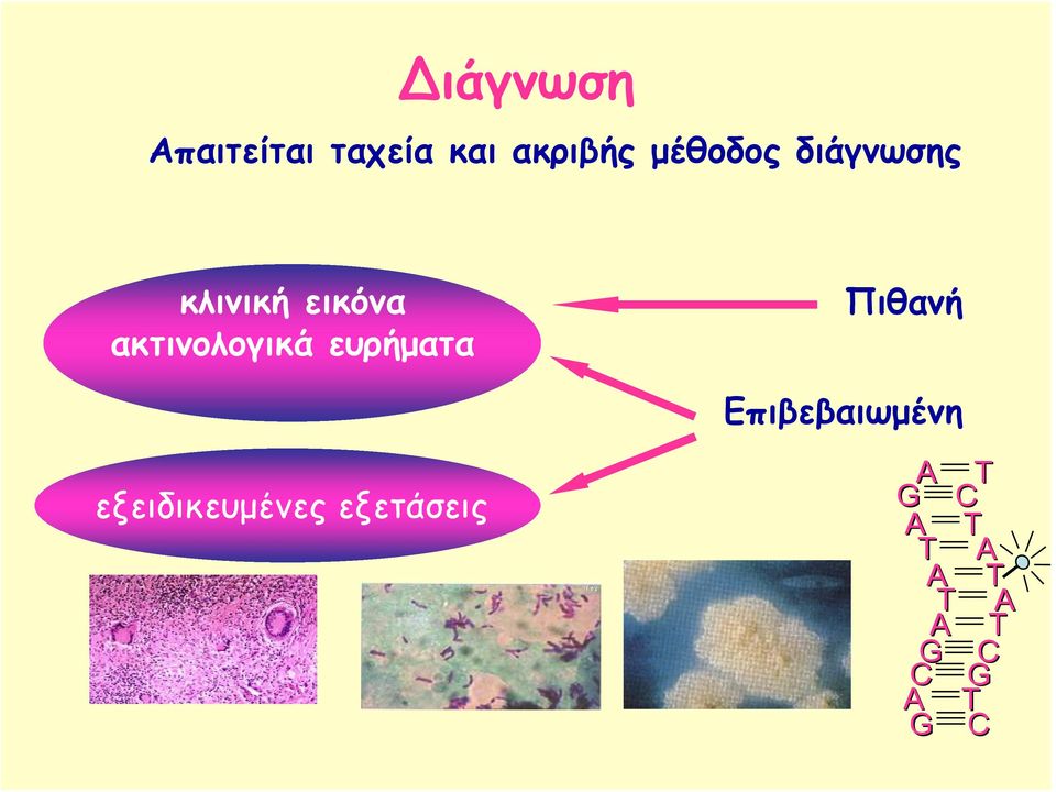 ακτινολογικά ευρήματα Πιθανή Επιβεβαιωμένη