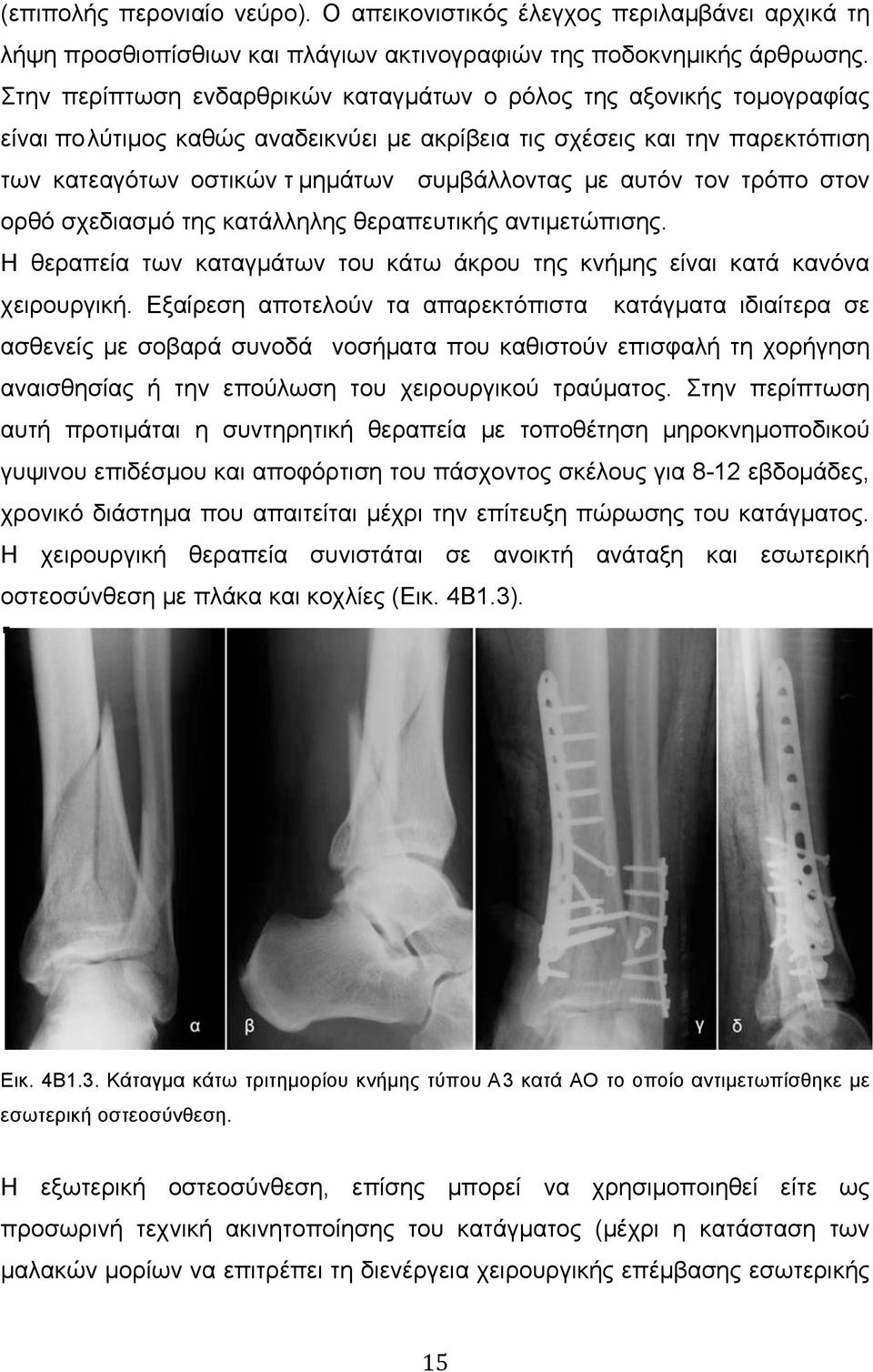 αυτόν τον τρόπο στον ορθό σχεδιασµό της κατάλληλης θεραπευτικής αντιµετώπισης. Η θεραπεία των καταγµάτων του κάτω άκρου της κνήµης είναι κατά κανόνα χειρουργική.
