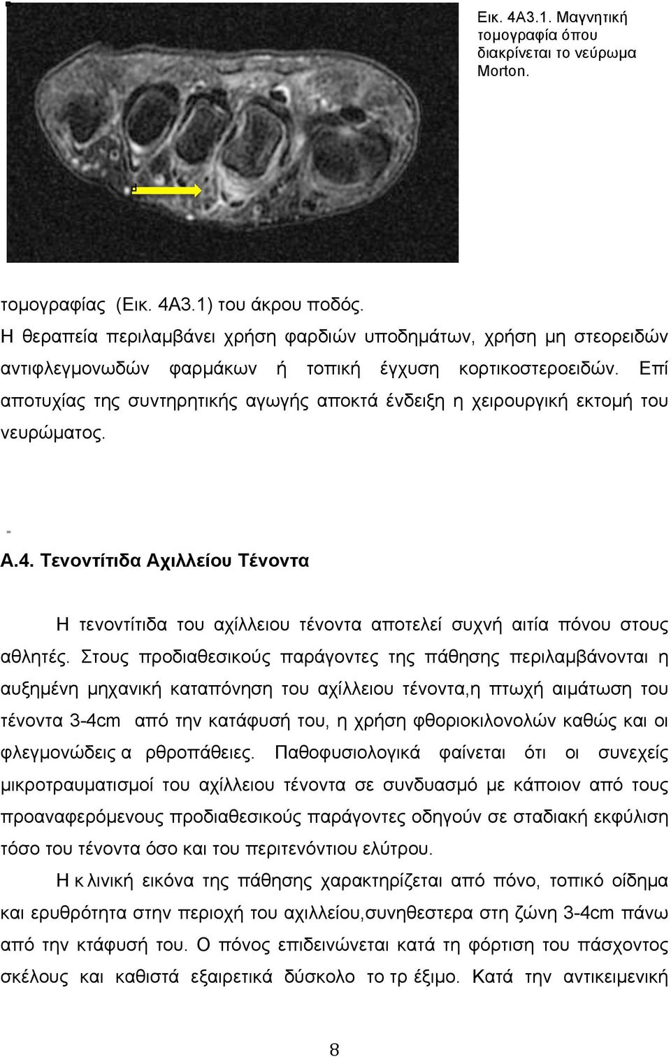 Επί αποτυχίας της συντηρητικής αγωγής αποκτά ένδειξη η χειρουργική εκτοµή του νευρώµατος. Α.4.