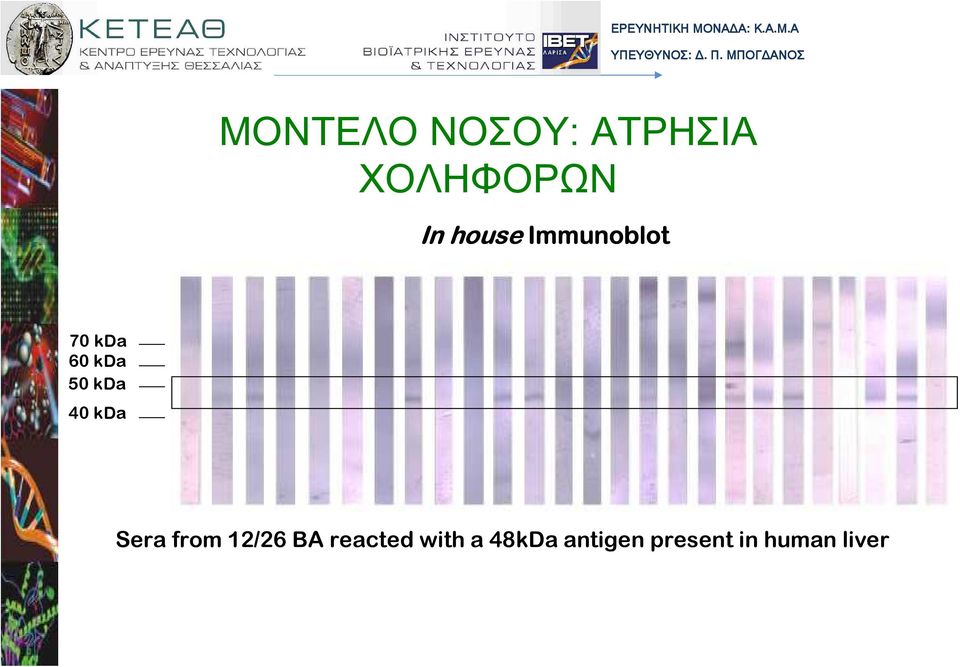 Immunoblot 70 kda 60 kda 50 kda 40 kda Sera from