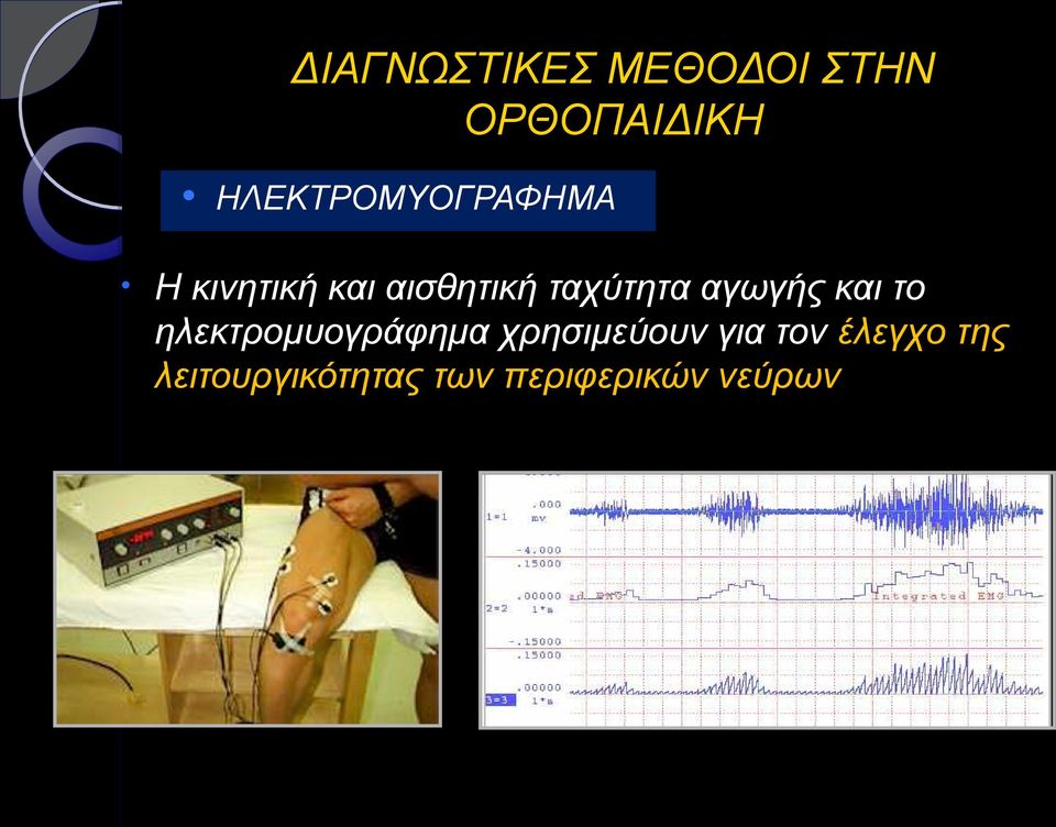 ηλεκτρομυογράφημα χρησιμεύουν για τον