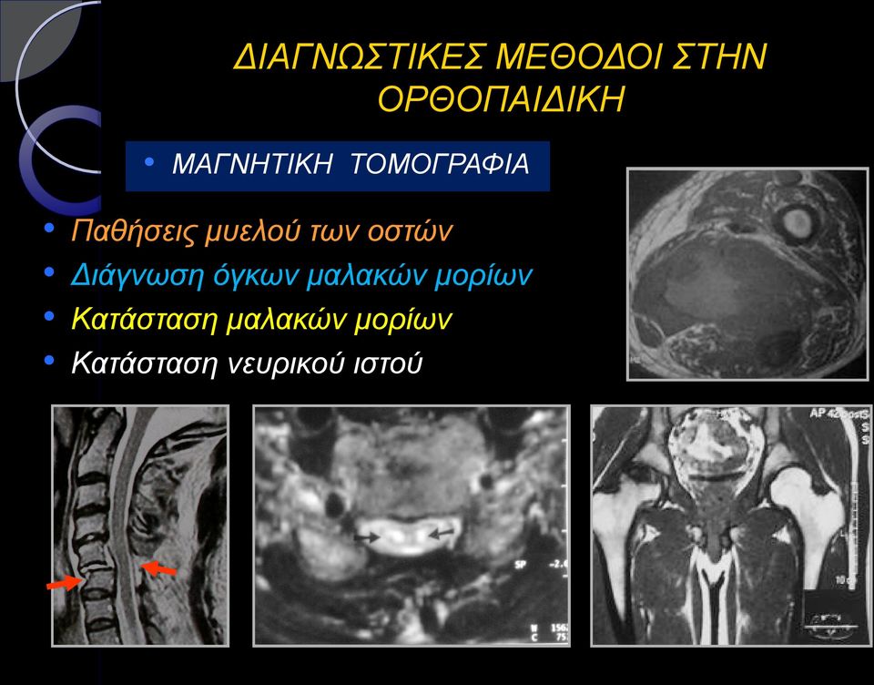 μαλακών μορίων Κατάσταση