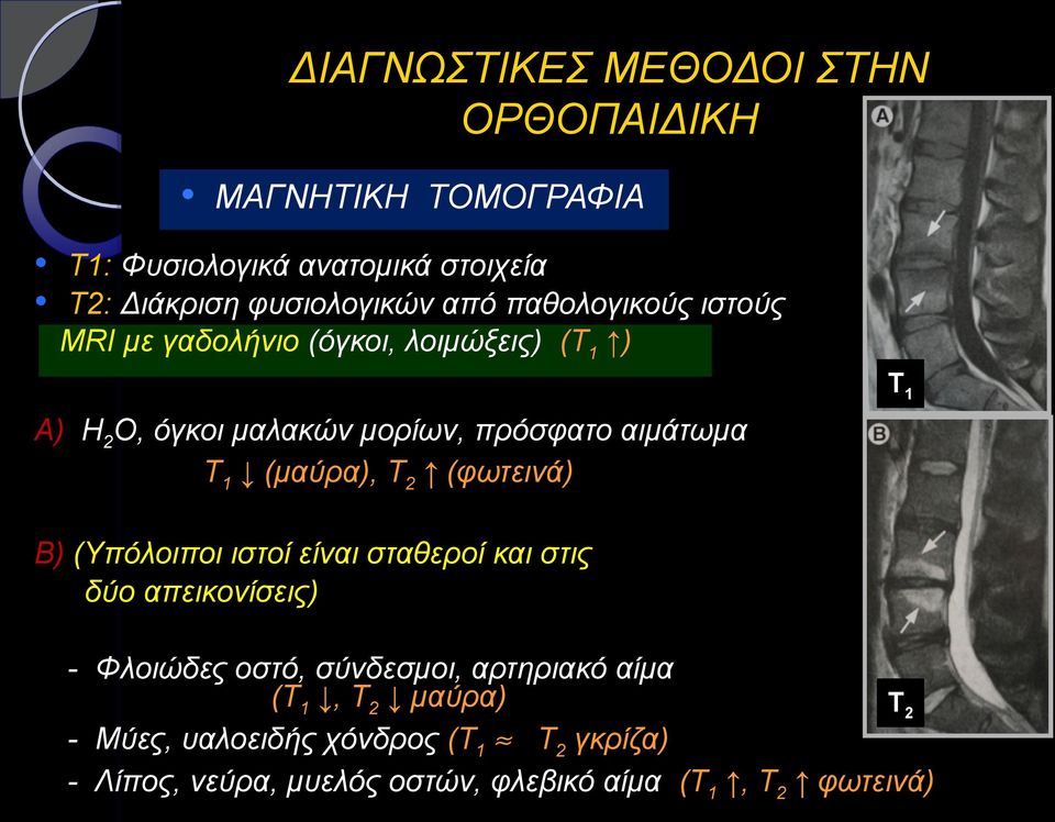 (φωτεινά) Β) (Υπόλοιποι ιστοί είναι σταθεροί και στις δύο απεικονίσεις) - Φλοιώδες οστό, σύνδεσμοι, αρτηριακό