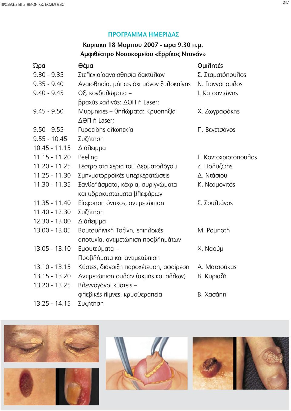 Ζωγραφάκης ΔΘΠ ή Laser; 9.50-9.55 Γυροειδής αλωπεκία Π. Βενετσάνος 9.55-10.45 Συζήτηση 10.45-11.15 Διάλειμμα 11.15-11.20 Peeling Γ. Κοντοχριστόπουλος 11.20-11.25 Ξέστρο στα χέρια του Δερματολόγου Ζ.