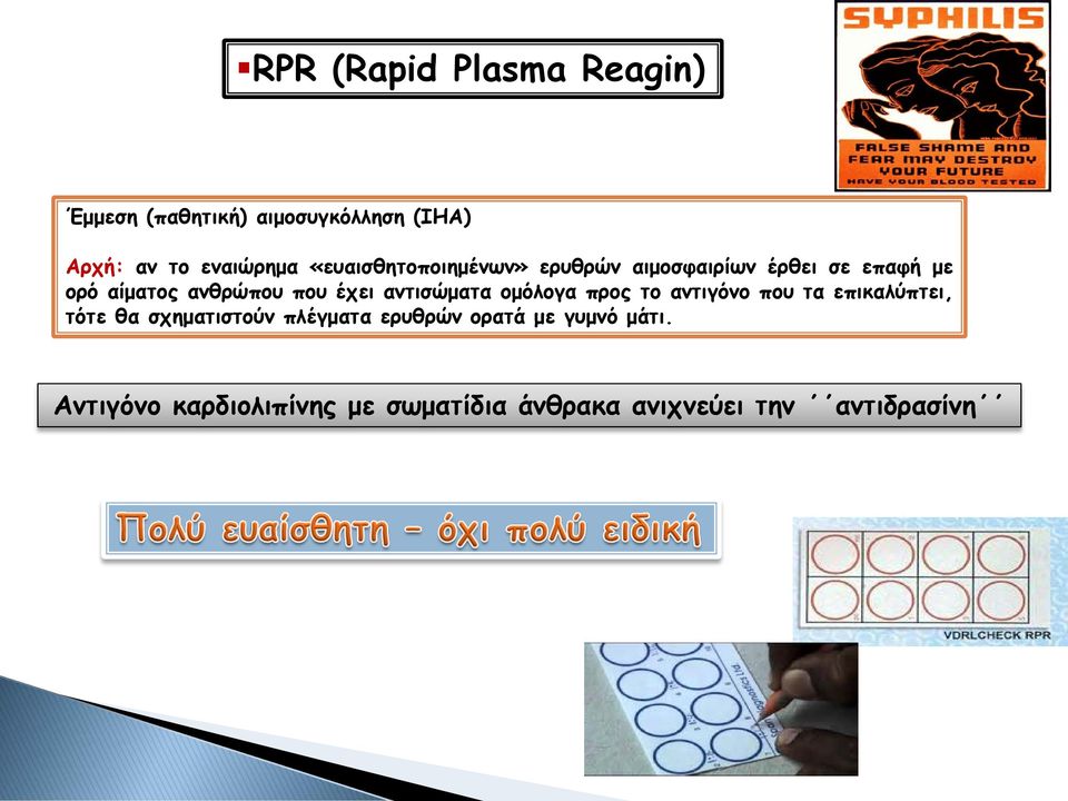 αντισώματα ομόλογα προς το αντιγόνο που τα επικαλύπτει, τότε θα σχηματιστούν πλέγματα