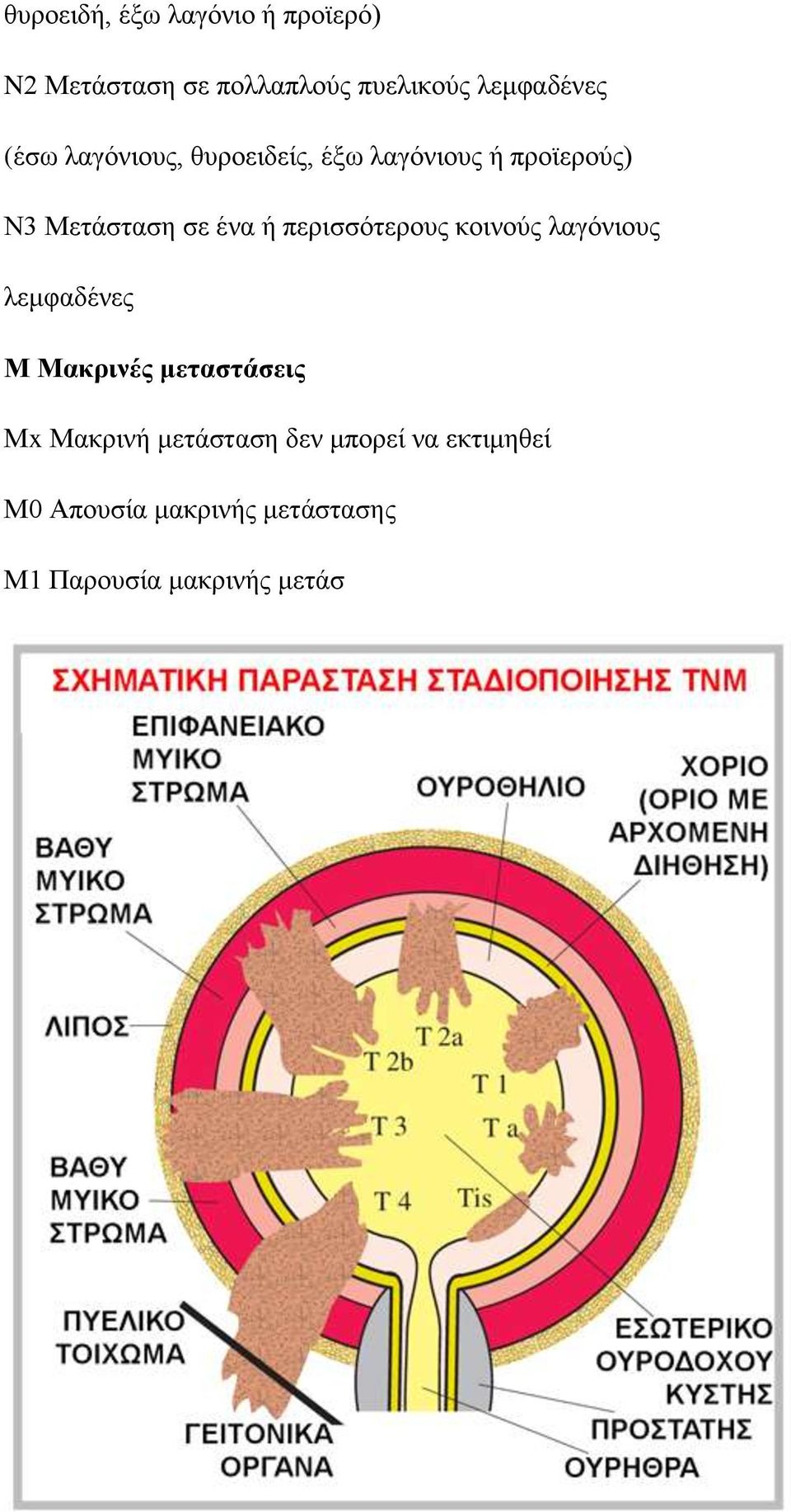 περισσότερους κοινούς λαγόνιους λεμφαδένες Μ Μακρινές μεταστάσεις Μx Μακρινή