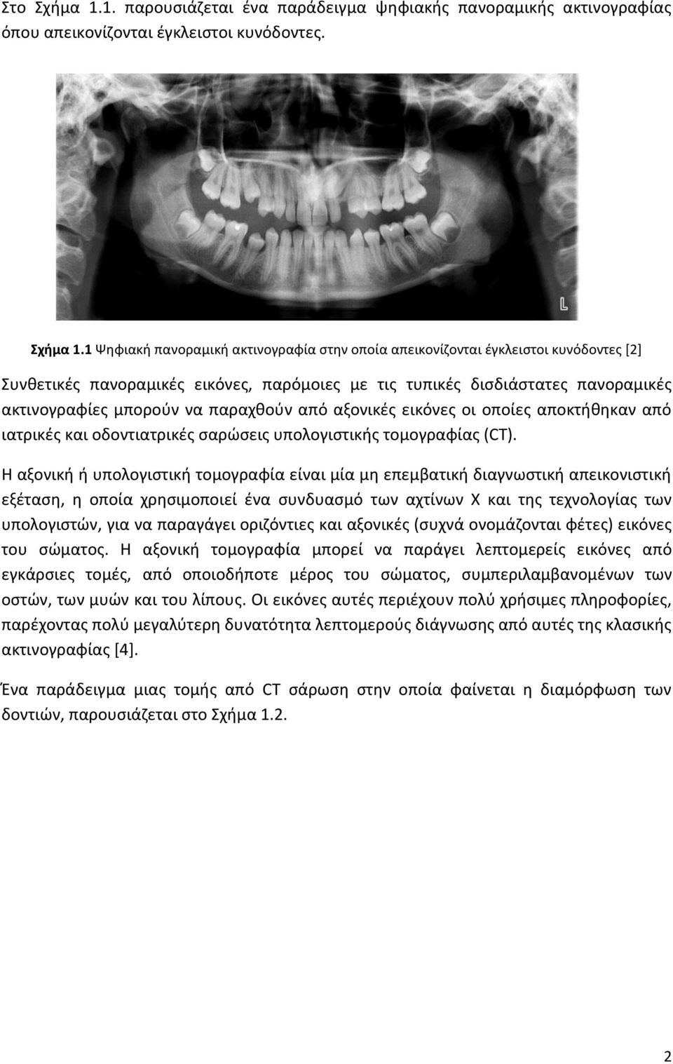 Ανακατασκευή Πανοραμικής Ακτινογραφίας Δοντιών από Αξονικές Τομογραφίες  ΔΙΠΛΩΜΑΤΙΚΗ ΕΡΓΑΣΙΑ - PDF Free Download