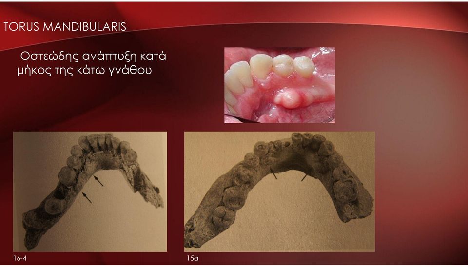 Οστεώδης ανάπτυξη