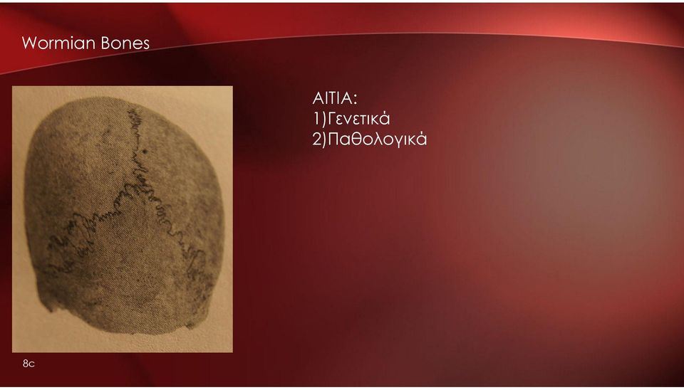 ΑΙΤΙΑ: