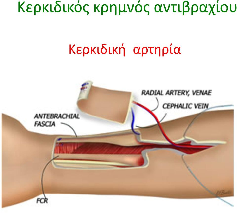 αντιβραχίου