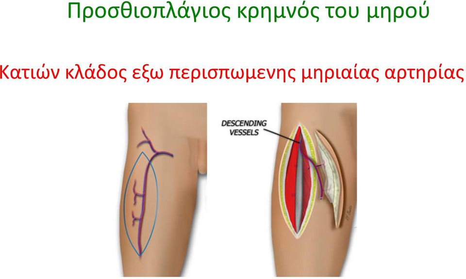 Κατιών κλάδος εξω