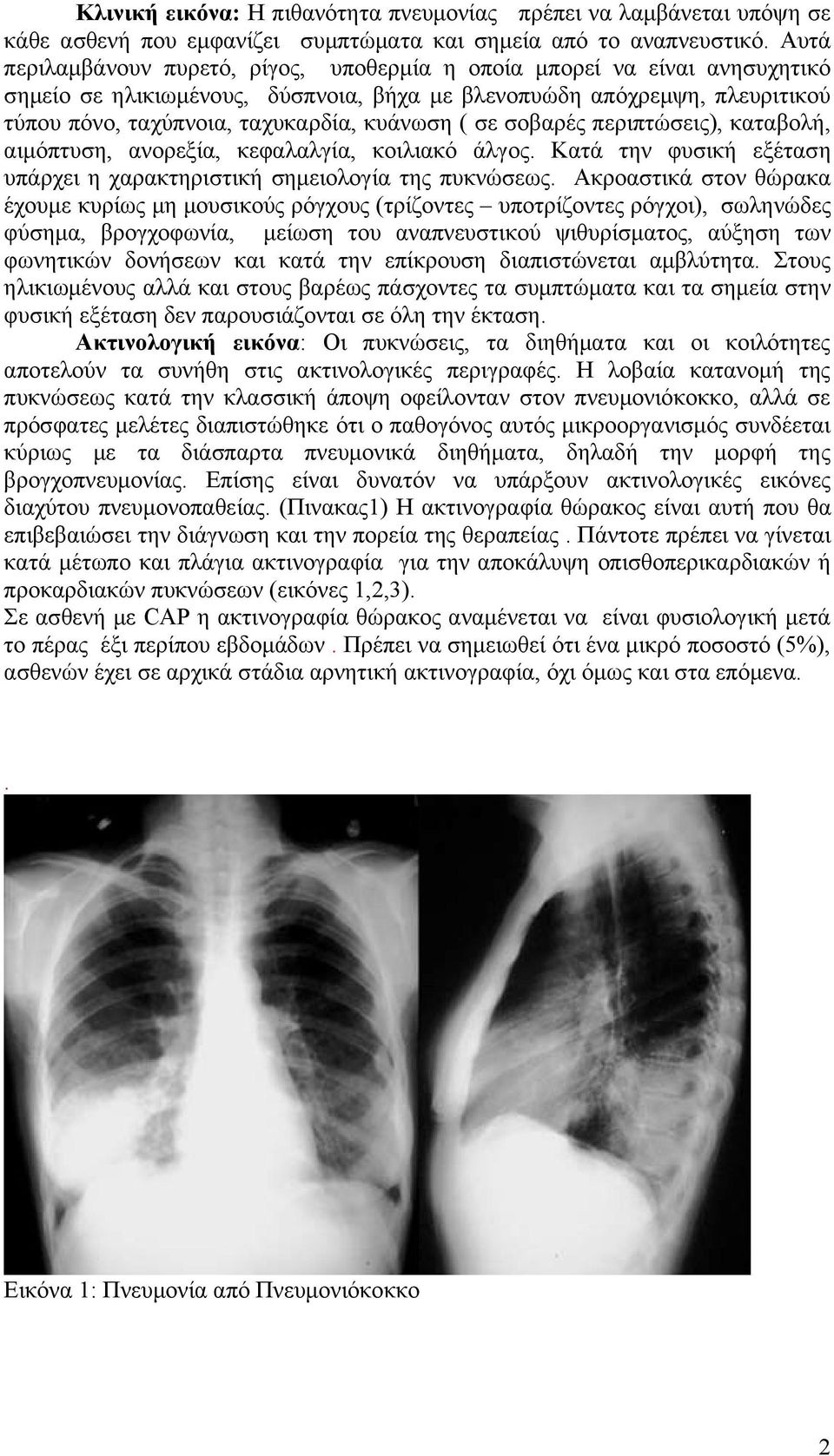 ( σε σοβαρές περιπτώσεις), καταβολή, αιμόπτυση, ανορεξία, κεφαλαλγία, κοιλιακό άλγος. Κατά την φυσική εξέταση υπάρχει η χαρακτηριστική σημειολογία της πυκνώσεως.