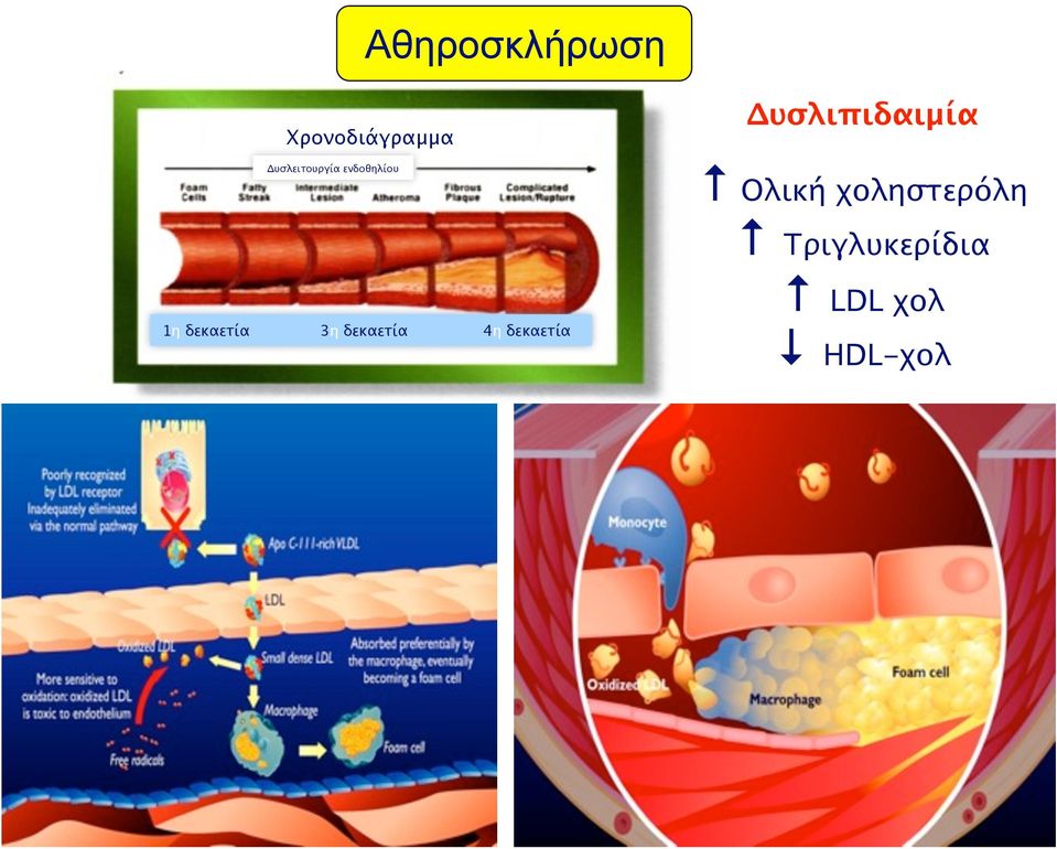 3η δεκαετία 4η δεκαετία Δυσλιπιδαιμία