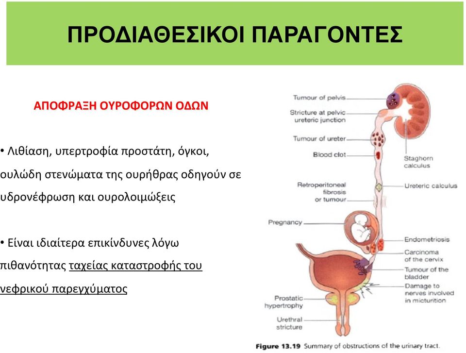 οδηγούν σε υδρονέφρωση και ουρολοιμώξεις Είναι ιδιαίτερα