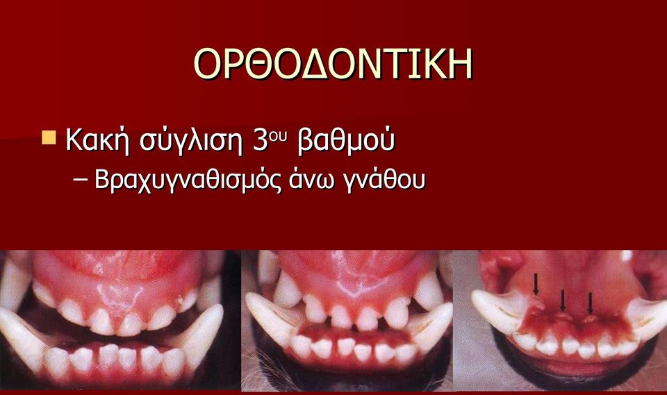 3ου βαθμού