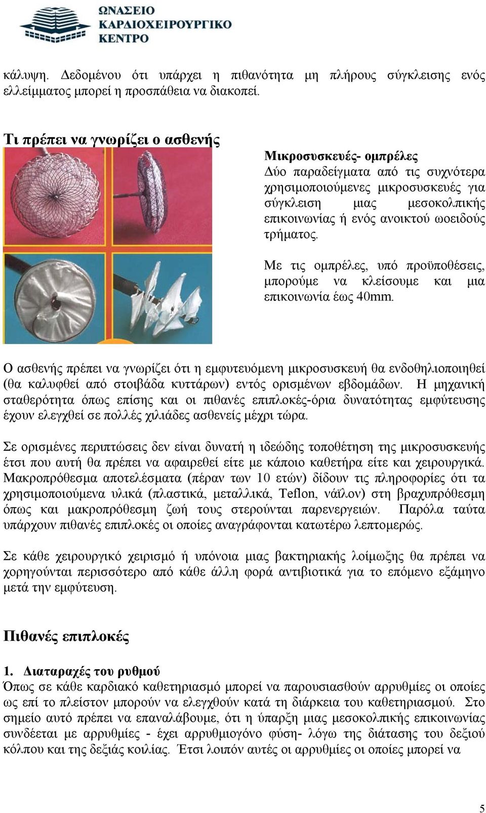 τρήματος. Με τις ομπρέλες, υπό προϋποθέσεις, μπορούμε να κλείσουμε και μια επικοινωνία έως 40mm.