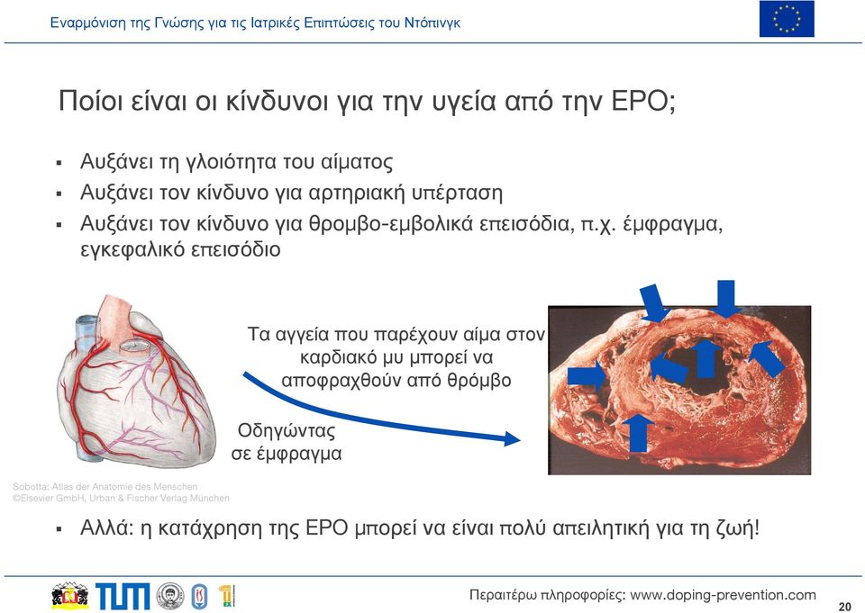 έμφραγμα, εγκεφαλικό επεισόδιο Τα αγγεία που παρέχουν αίμα στον καρδιακό μυ μπορεί να αποφραχθούν από θρόμβο