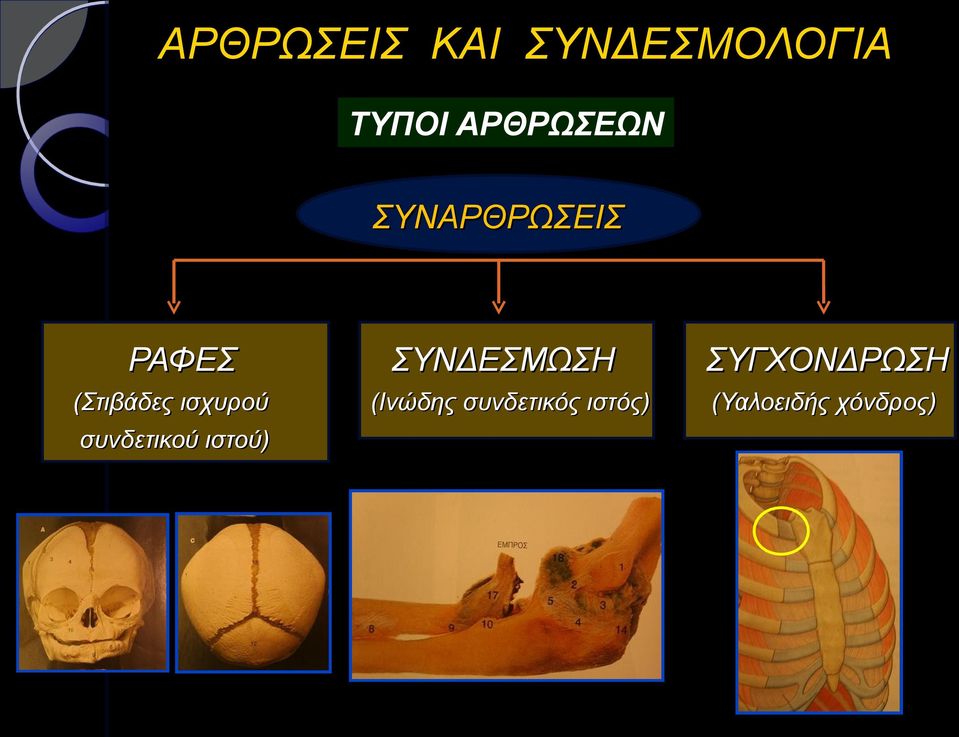 ισχυρού συνδετικού ιστού) ΣΥΝΔΕΣΜΩΣΗ