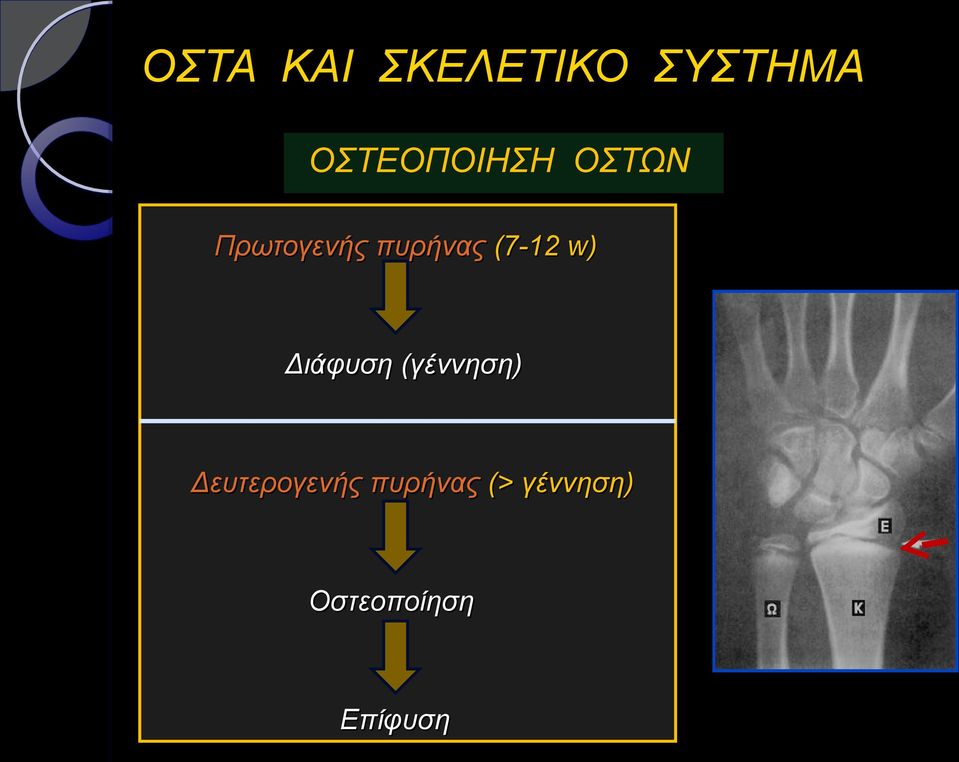 πυρήνας (7-12 w) Διάφυση (γέννηση)