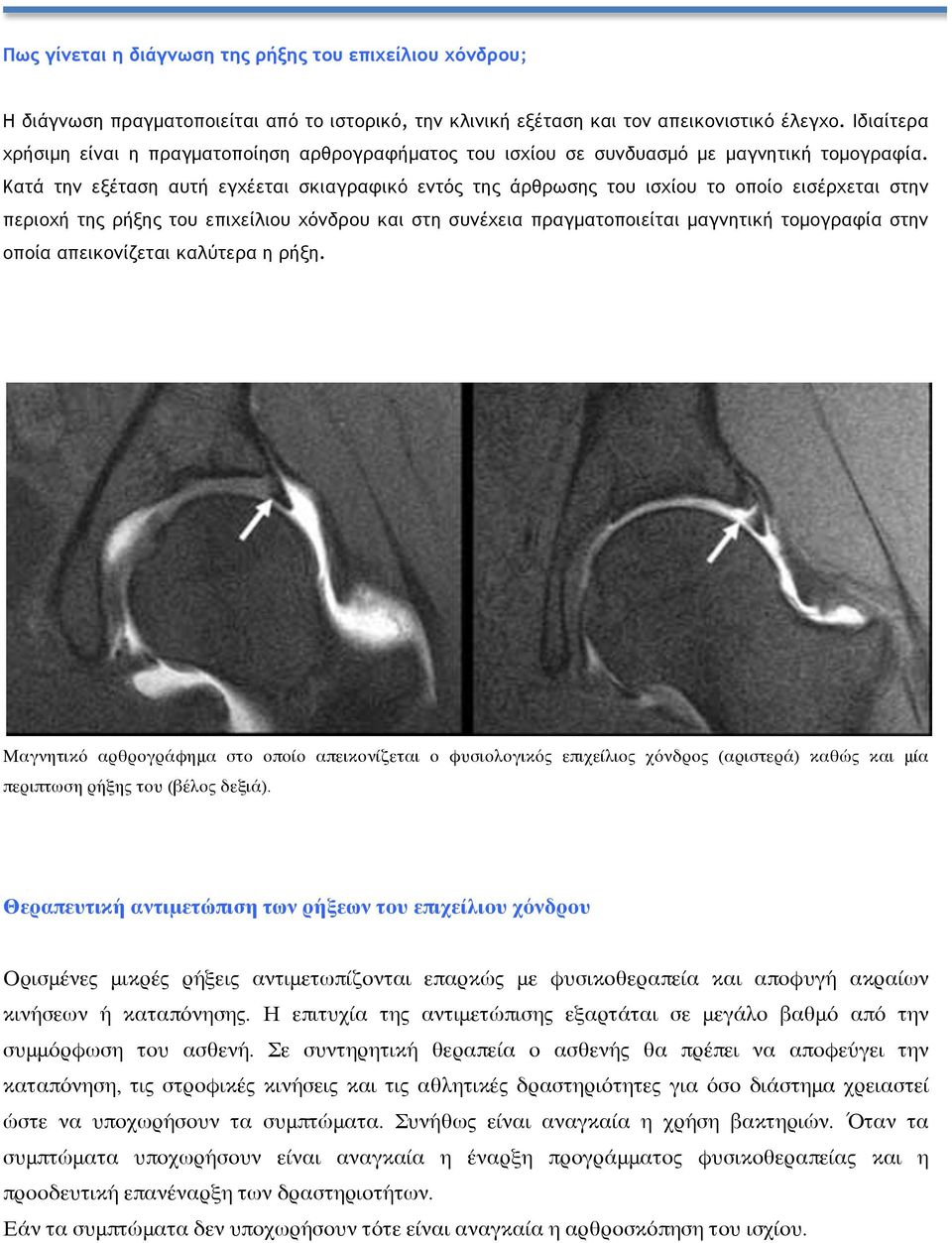 Κατά την εξέταση αυτή εγχέεται σκιαγραφικό εντός της άρθρωσης του ισχίου το οποίο εισέρχεται στην περιοχή της ρήξης του επιχείλιου χόνδρου και στη συνέχεια πραγµατοποιείται µαγνητική τοµογραφία στην