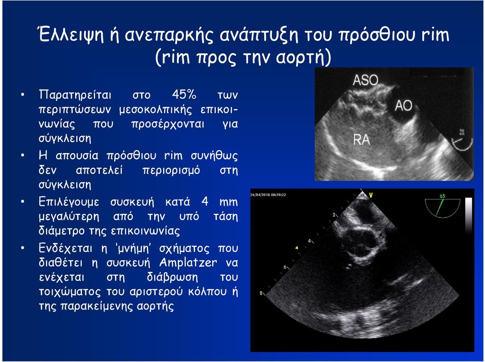 στη σύγκλειση Επιλέγουμε συσκευή κατά 4 mm μεγαλύτερη από την υπό τάση διάμετρο της επικοινωνίας Ενδέχεται η μνήμη