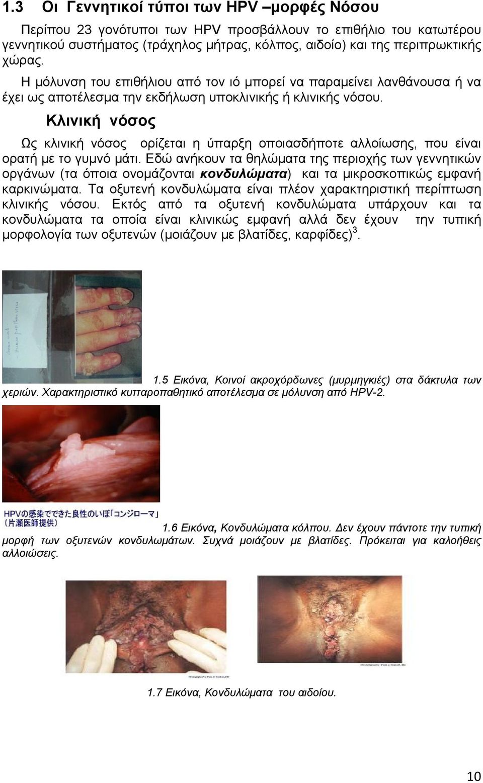 Κλινική νόσος Ως κλινική νόσος ορίζεται η ύπαρξη οποιασδήποτε αλλοίωσης, που είναι ορατή με το γυμνό μάτι.