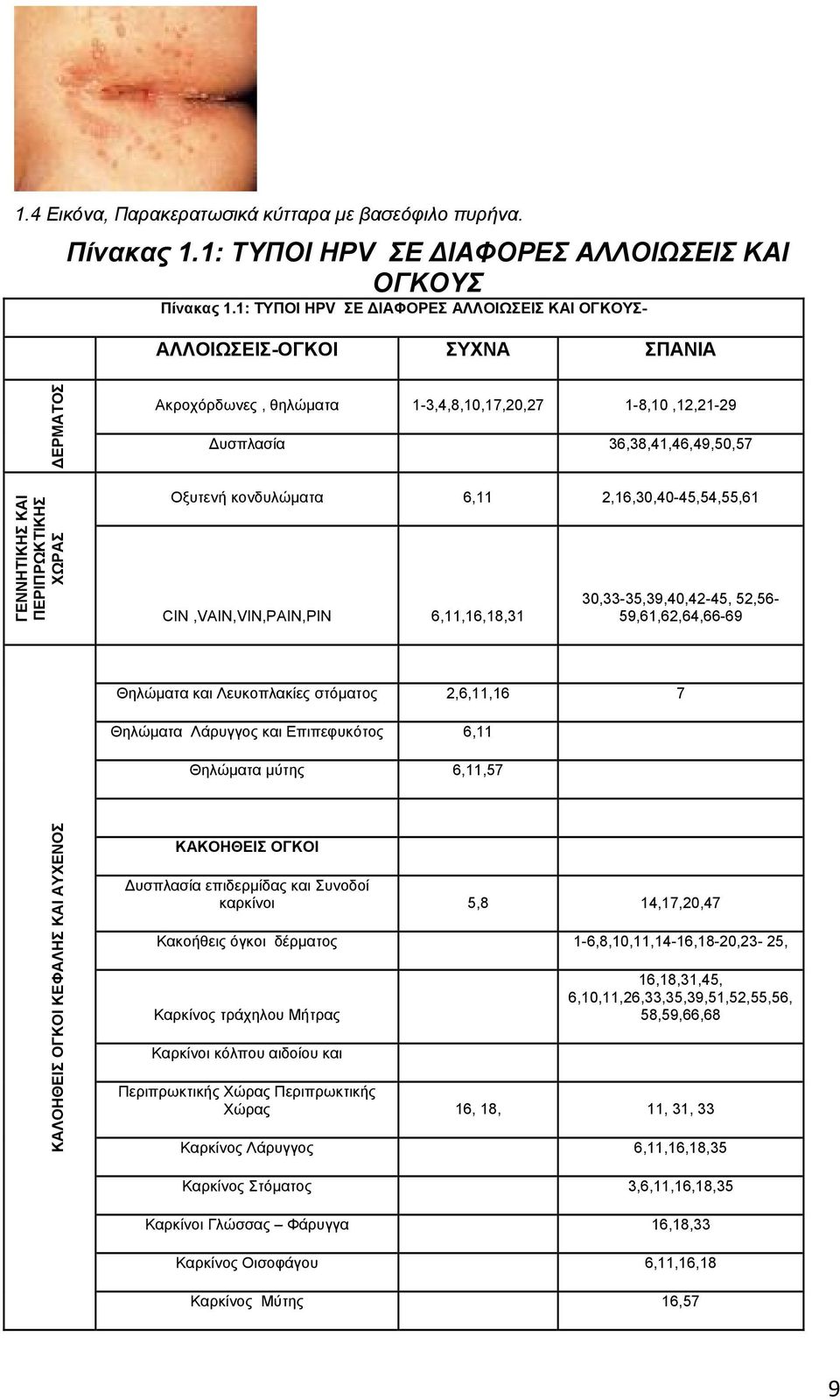 36,38,41,46,49,50,57 Οξυτενή κονδυλώματα 6,11 2,16,30,40-45,54,55,61 CIN,VAIN,VIN,PAIN,PIN 6,11,16,18,31 30,33-35,39,40,42-45, 52,56-59,61,62,64,66-69 Θηλώματα και Λευκοπλακίες στόματος 2,6,11,16 7