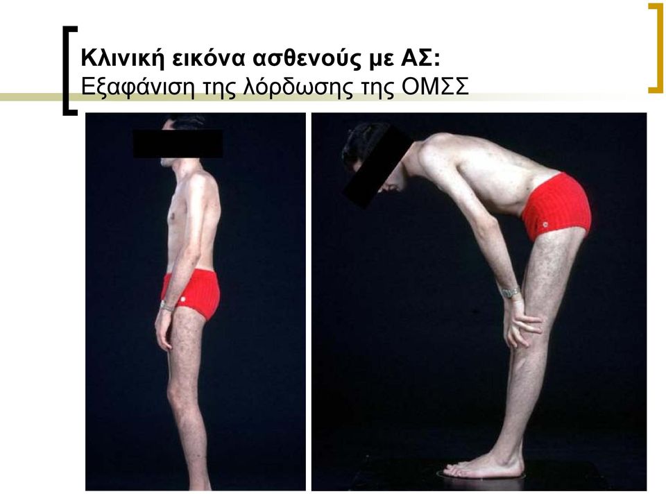 Eξαφάνιση της