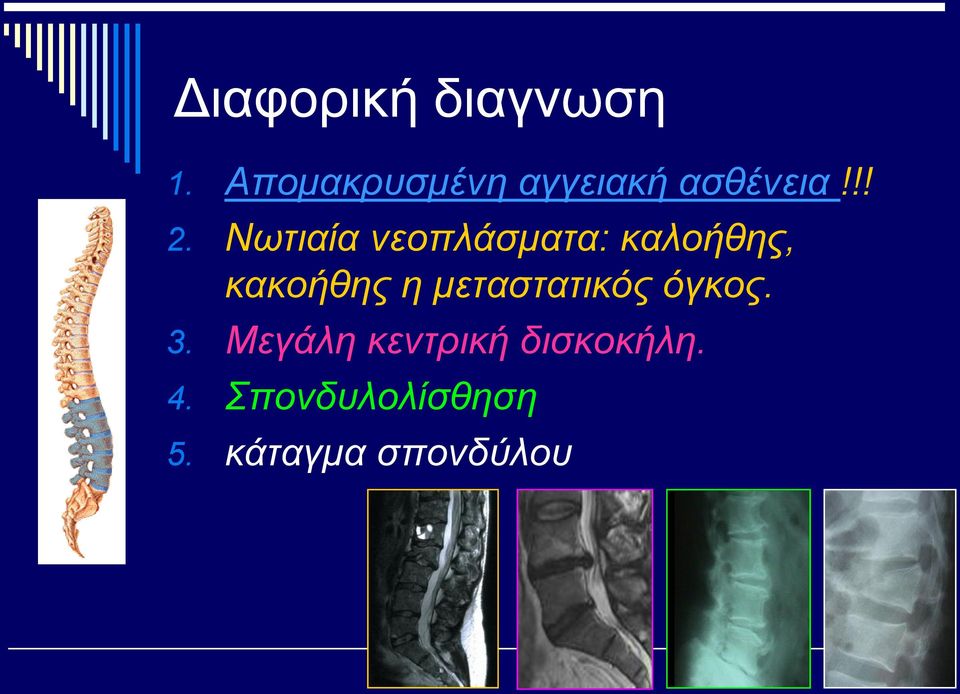 Νωτιαία νεοπλάσματα: καλοήθης, κακοήθης η