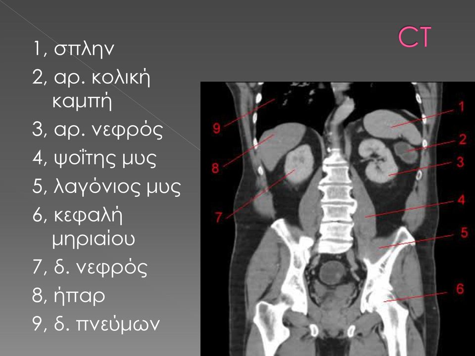 νεφρός 4, ψοΐτης μυς 5,