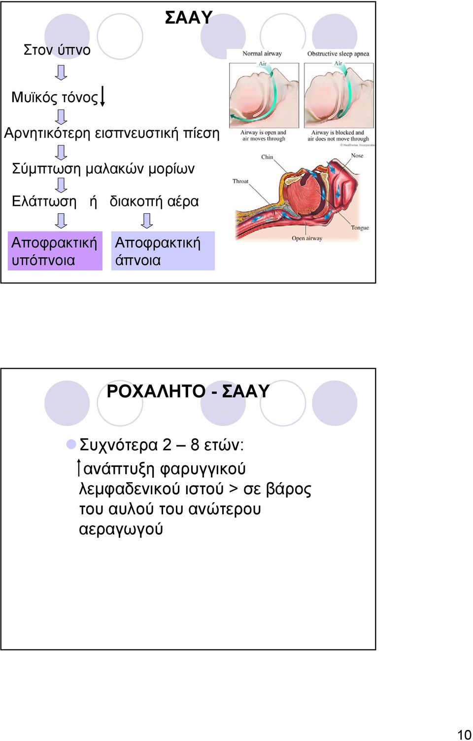 υπόπνοια Αποφρακτική άπνοια ΡΟΧΑΛΗΤΟ - ΣΑΑΥ Συχνότερα 2 8 ετών: