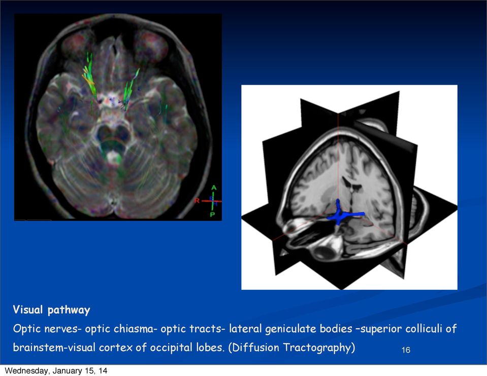 superior colliculi of brainstem-visual