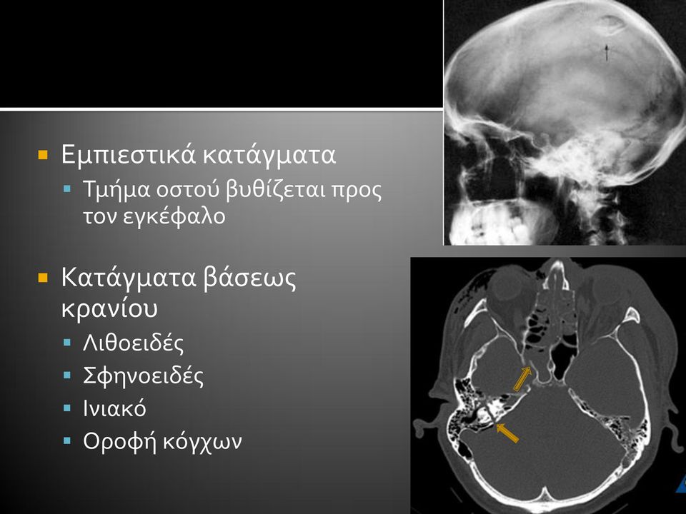 Δεν συνιστάται ακτινογραφία σε ασθενείς χαμηλού κινδύνου Η αξονική  τομογραφία είναι η πιο κατάλληλη εξέταση επειδή τι συμβαίνει στον εγκέφαλο  είναι - PDF ΔΩΡΕΑΝ Λήψη