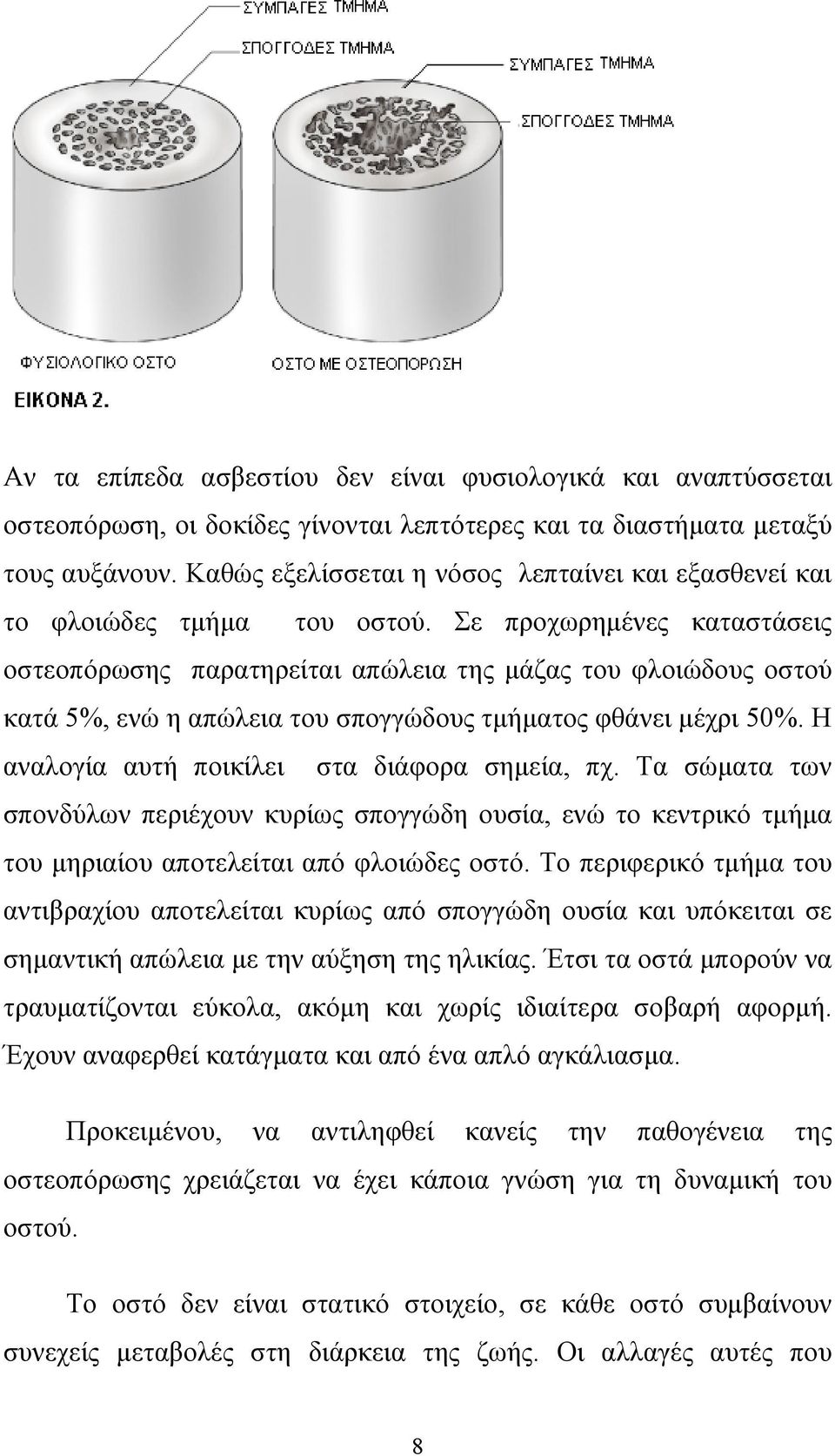 Σε προχωρηµένες καταστάσεις οστεοπόρωσης παρατηρείται απώλεια της µάζας του φλοιώδους οστού κατά 5%, ενώ η απώλεια του σπογγώδους τµήµατος φθάνει µέχρι 50%.