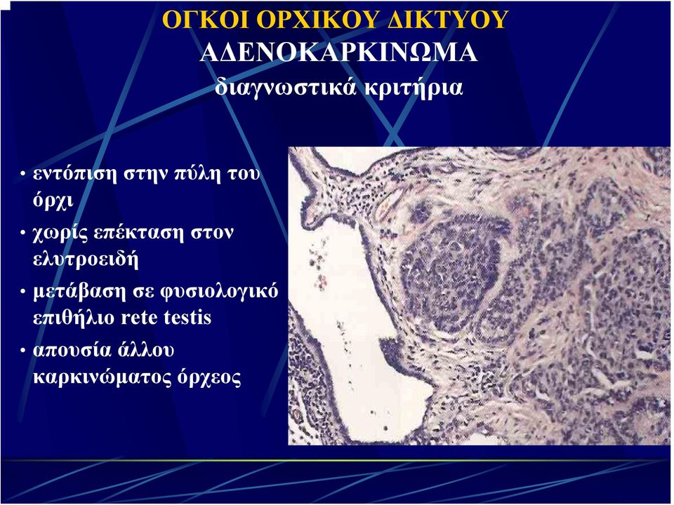 επέκταση στον ελυτροειδή μετάβαση σε φυσιολογικό