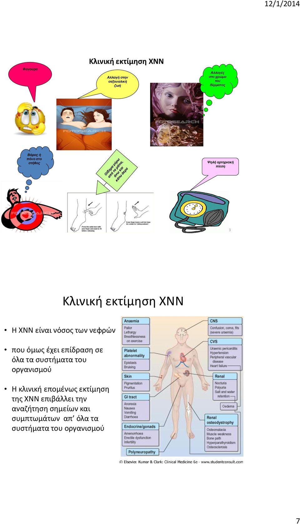 νόσος των νεφρών που όμως έχει επίδραση σε όλα τα συστήματα του οργανισμού Η κλινική επομένως