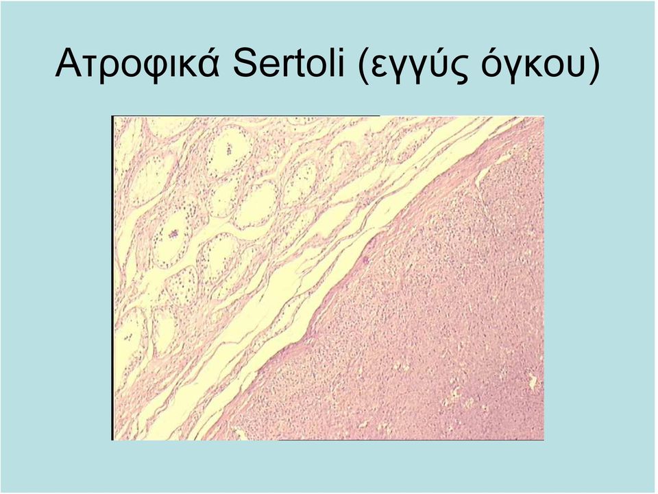 (εγγύς