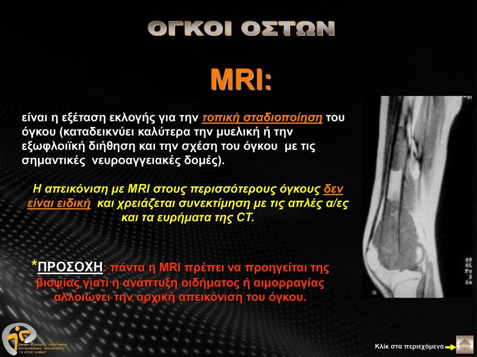 Η απεικόνιση με MRI στους περισσότερους όγκους δεν είναι ειδική και χρειάζεται συνεκτίμηση με τις απλές α/ες και τα
